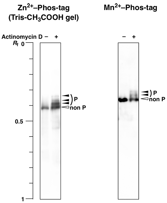 ATM tris acetate